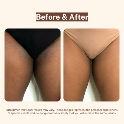 BBL Serum - 3-in-1 Bikini Line Serum