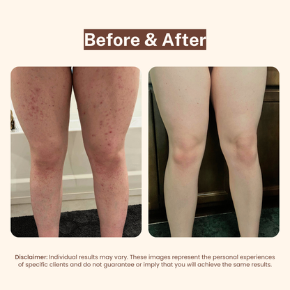 BBL Serum - 3-in-1 Bikini Line Serum